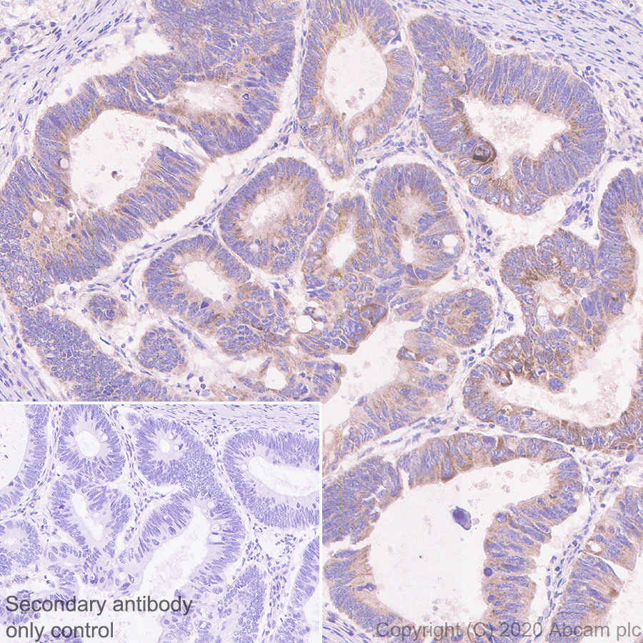 Immunohistochemistry (Formalin/PFA-fixed paraffin-embedded sections) - Anti-Bcl-XL antibody [2H12] - BSA and Azide free (AB252257), expandable thumbnail