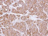 Immunohistochemistry (Formalin/PFA-fixed paraffin-embedded sections) - Anti-Bcl-XL antibody (AB98143), expandable thumbnail