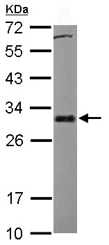 Western blot - Anti-Bcl-XL antibody (AB98143), expandable thumbnail