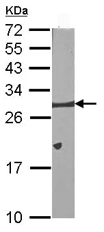 Western blot - Anti-Bcl-XL antibody (AB98143)