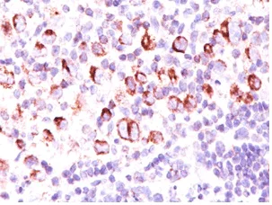Immunohistochemistry (Formalin/PFA-fixed paraffin-embedded sections) - Anti-Bcl-XL antibody [BX006 + 2H12] - BSA and Azide free (AB212813)