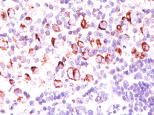Immunohistochemistry (Formalin/PFA-fixed paraffin-embedded sections) - Anti-Bcl-XL antibody [BX006 + 2H12] - N-terminal (AB201335), expandable thumbnail