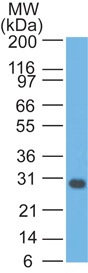 Western blot - Anti-Bcl-XL antibody [BX006 + 2H12] - N-terminal (AB201335), expandable thumbnail