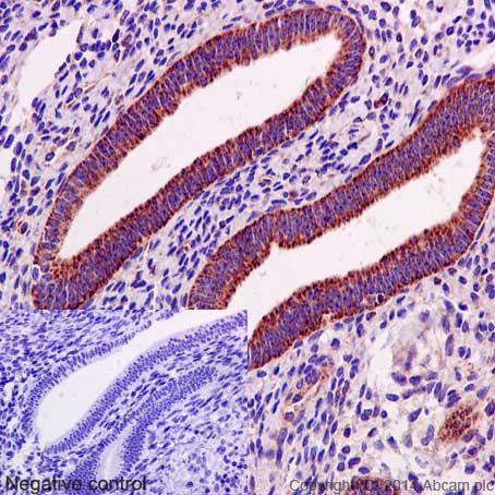 Immunohistochemistry (Formalin/PFA-fixed paraffin-embedded sections) - Anti-Bcl-XL antibody [E18] (ab32370), expandable thumbnail