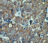 Immunohistochemistry (Formalin/PFA-fixed paraffin-embedded sections) - Anti-Bcl-XL antibody [E18] (ab32370), expandable thumbnail