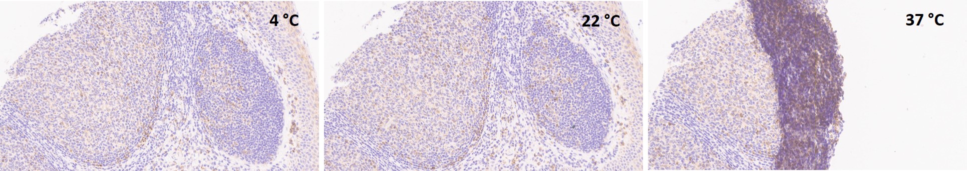 Immunohistochemistry (Formalin/PFA-fixed paraffin-embedded sections) - Anti-Bcl-XL antibody [E18] (AB32370)