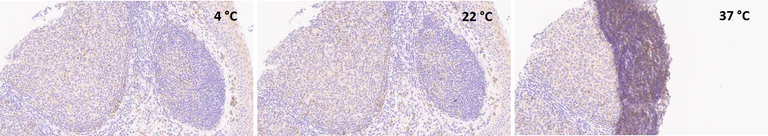 Immunohistochemistry (Formalin/PFA-fixed paraffin-embedded sections) - Anti-Bcl-XL antibody [E18] (AB32370)
