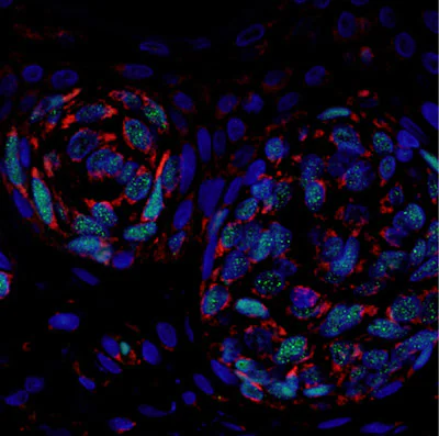 Immunohistochemistry (Formalin/PFA-fixed paraffin-embedded sections) - Anti-Bcl-XL antibody [E18] - BSA and Azide free (AB199099)