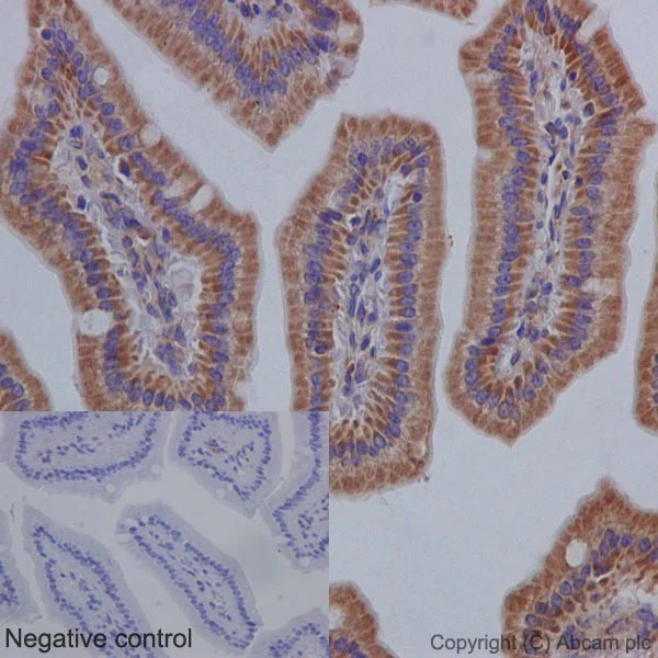 Immunohistochemistry (Formalin/PFA-fixed paraffin-embedded sections) - Anti-Bcl-XL antibody [EPR16642] - BSA and Azide free (AB223547)