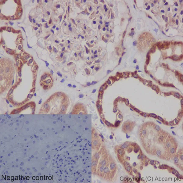 Immunohistochemistry (Formalin/PFA-fixed paraffin-embedded sections) - Anti-Bcl-XL antibody [EPR16642] - BSA and Azide free (AB223547)