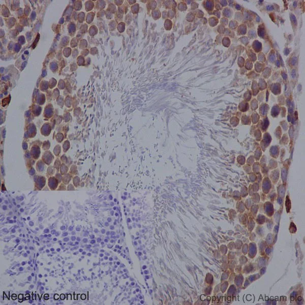 Immunohistochemistry (Formalin/PFA-fixed paraffin-embedded sections) - Anti-Bcl-XL antibody [EPR16642] - BSA and Azide free (AB223547)