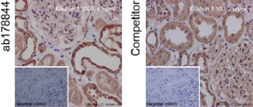 Immunohistochemistry (Formalin/PFA-fixed paraffin-embedded sections) - Anti-Bcl-XL antibody [EPR16642] - BSA and Azide free (AB223547)