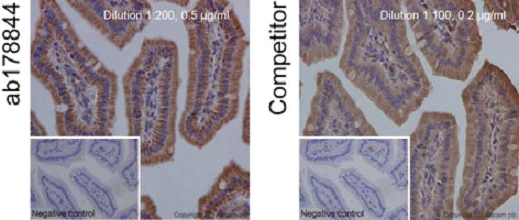 Immunohistochemistry (Formalin/PFA-fixed paraffin-embedded sections) - Anti-Bcl-XL antibody [EPR16642] - BSA and Azide free (AB223547)