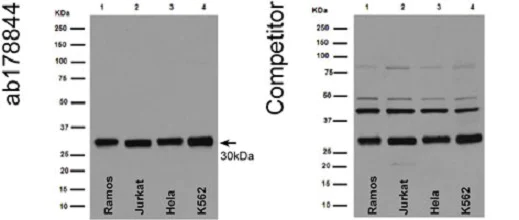 Western blot - Anti-Bcl-XL antibody [EPR16642] - BSA and Azide free (AB223547)