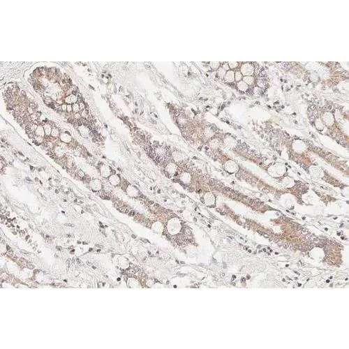 Immunohistochemistry (Formalin/PFA-fixed paraffin-embedded sections) - Anti-Bcl-XL antibody [HL2039] (AB317127)