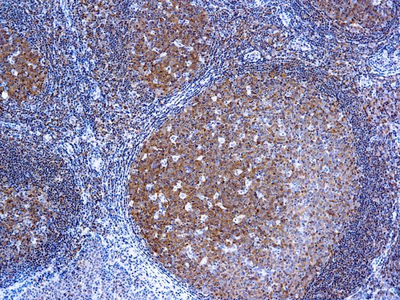 Immunohistochemistry (Formalin/PFA-fixed paraffin-embedded sections) - Anti-Bcl10 antibody [151] (AB93022)