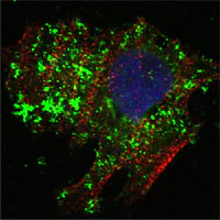 Immunocytochemistry/ Immunofluorescence - Anti-Bcl10 antibody [4F8E8H8] (AB36585)