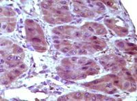 Immunohistochemistry (Formalin/PFA-fixed paraffin-embedded sections) - Anti-Bcl10 antibody [4F8E8H8] (AB36585)