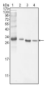 Western blot - Anti-Bcl10 antibody [4F8E8H8] (AB36585)