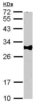 Western blot - Anti-Bcl10 antibody (AB155657)
