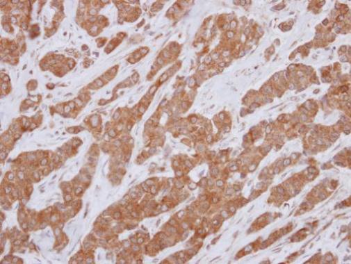 Immunohistochemistry (Formalin/PFA-fixed paraffin-embedded sections) - Anti-Bcl10 antibody (AB227156), expandable thumbnail