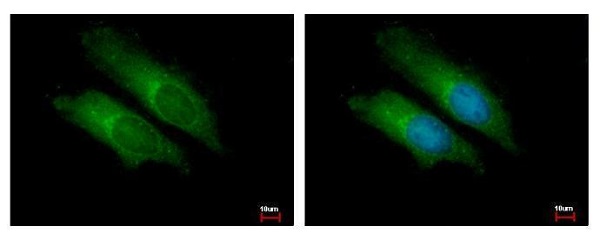 Immunocytochemistry/ Immunofluorescence - Anti-Bcl10 antibody (AB227206)