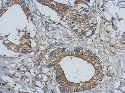 Immunohistochemistry (Formalin/PFA-fixed paraffin-embedded sections) - Anti-Bcl10 antibody (AB227206)