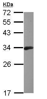Western blot - Anti-Bcl10 antibody (AB227206)
