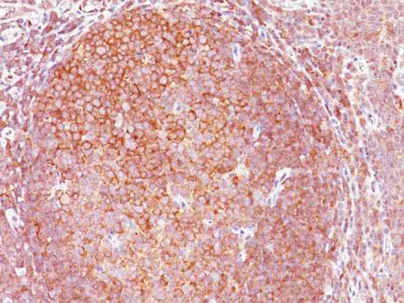Immunohistochemistry (Formalin/PFA-fixed paraffin-embedded sections) - Anti-Bcl10 antibody [BL10/411] (AB199011)