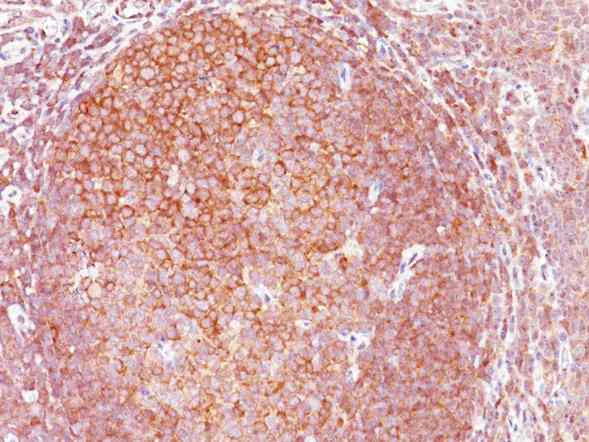 Immunohistochemistry (Formalin/PFA-fixed paraffin-embedded sections) - Anti-Bcl10 antibody [BL10/411] (AB199011)