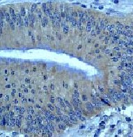 Immunohistochemistry (Formalin/PFA-fixed paraffin-embedded sections) - Anti-Bcl10 antibody [ep605y] (AB40752)