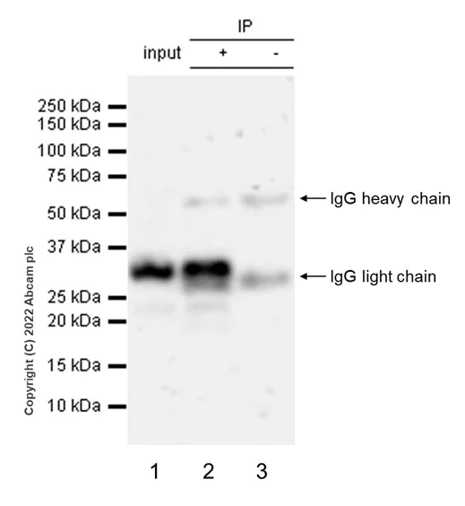 Immunoprecipitation - Anti-Bcl10 antibody [ep605y] - BSA and Azide free (AB189218)