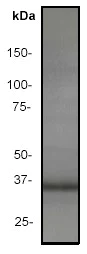 Western blot - Anti-Bcl10 antibody [ep605y] - BSA and Azide free (AB189218)