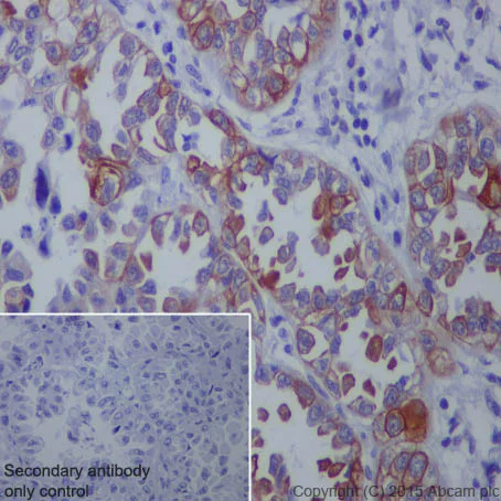 Immunohistochemistry (Formalin/PFA-fixed paraffin-embedded sections) - Anti-Bcl10 antibody [EP606Y] - BSA and Azide free (AB189219)