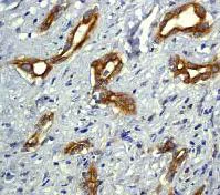 Immunohistochemistry (Formalin/PFA-fixed paraffin-embedded sections) - Anti-Bcl10 antibody [EP606Y] - BSA and Azide free (AB189219)