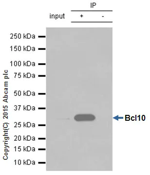 Immunoprecipitation - Anti-Bcl10 antibody [EP606Y] - BSA and Azide free (AB189219)