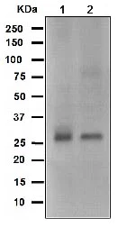 Western blot - Anti-Bcl10 antibody [EPR3174] (AB108412)