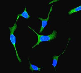 Immunocytochemistry/ Immunofluorescence - Anti-Bcl10 antibody [EPR3175] (AB108328)