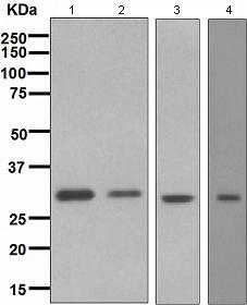 Western blot - Anti-Bcl10 antibody [EPR3175] (AB108328)