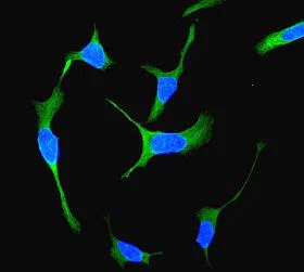 Immunocytochemistry/ Immunofluorescence - Anti-Bcl10 antibody [EPR3175] - BSA and Azide free (AB247632)