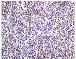 Immunohistochemistry (Formalin/PFA-fixed paraffin-embedded sections) - Anti-Bcl10 antibody [EPR8587] (AB150380)