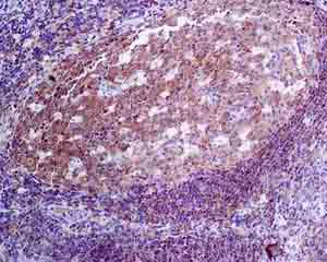 Immunohistochemistry (Formalin/PFA-fixed paraffin-embedded sections) - Anti-Bcl10 antibody [EPR8587] (AB150380)