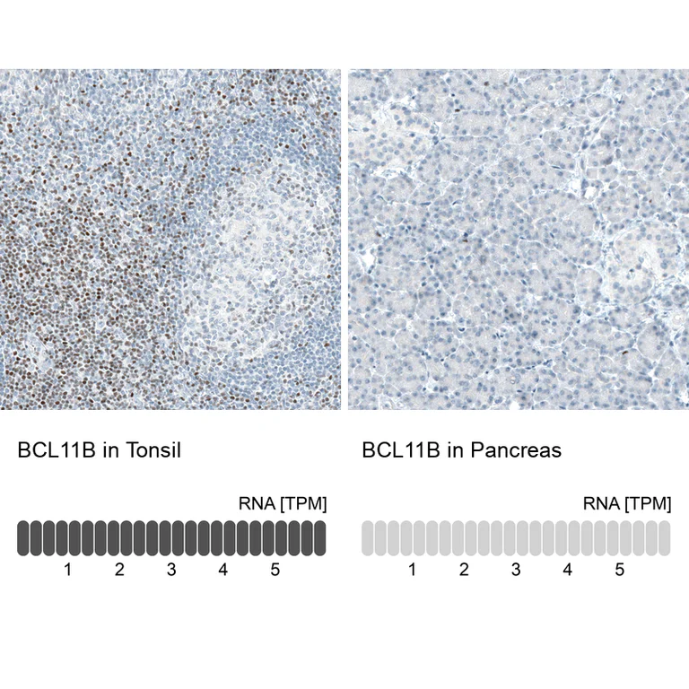 Immunohistochemistry (Formalin/PFA-fixed paraffin-embedded sections) - Anti-BCL11B Antibody [CL6426] (AB327121)
