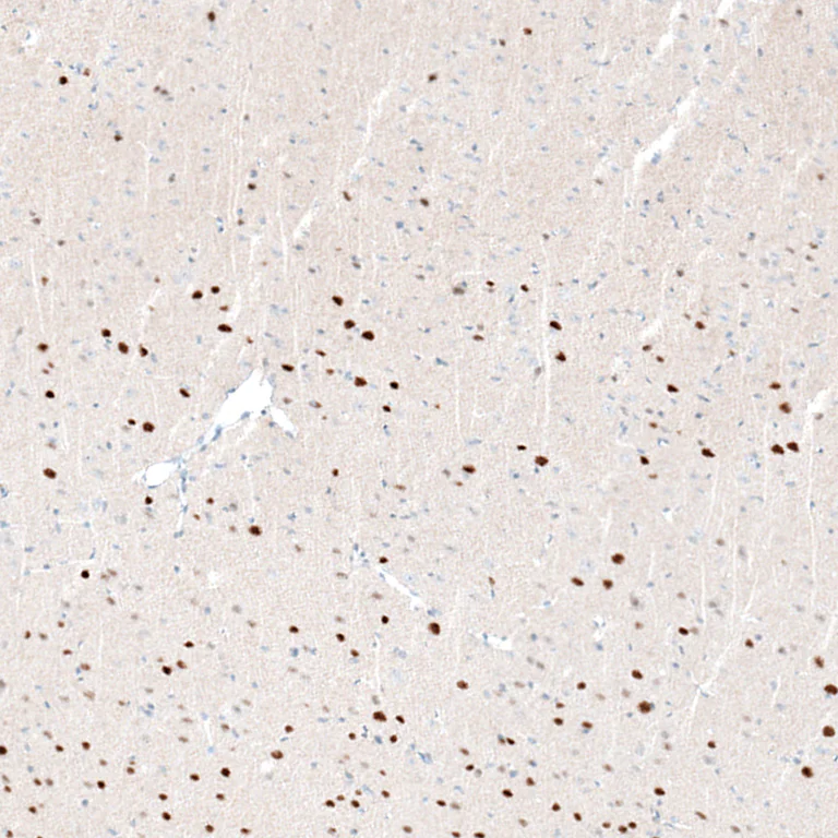 Immunohistochemistry (Formalin/PFA-fixed paraffin-embedded sections) - Anti-BCL11B Antibody [CL6426] (AB327121)