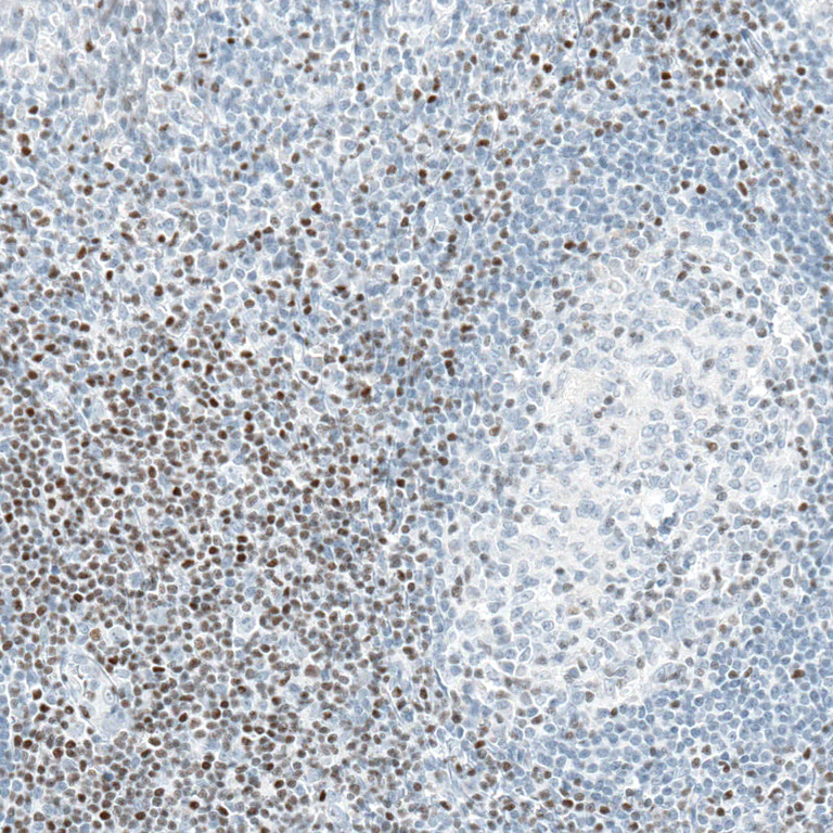 Immunohistochemistry (Formalin/PFA-fixed paraffin-embedded sections) - Anti-BCL11B Antibody [CL6426] (AB327121)
