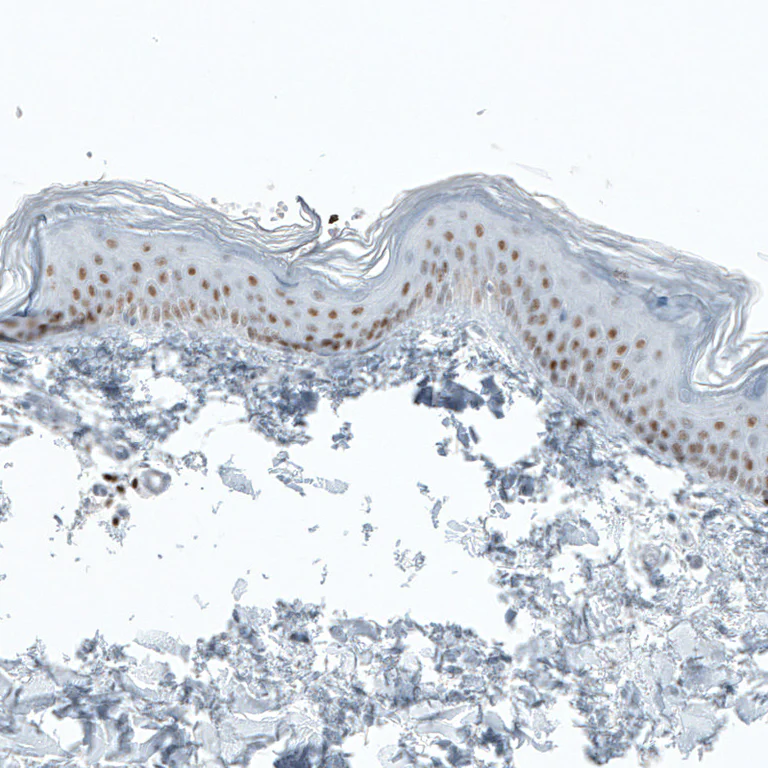 Immunohistochemistry (Formalin/PFA-fixed paraffin-embedded sections) - Anti-BCL11B Antibody [CL6426] (AB327121)