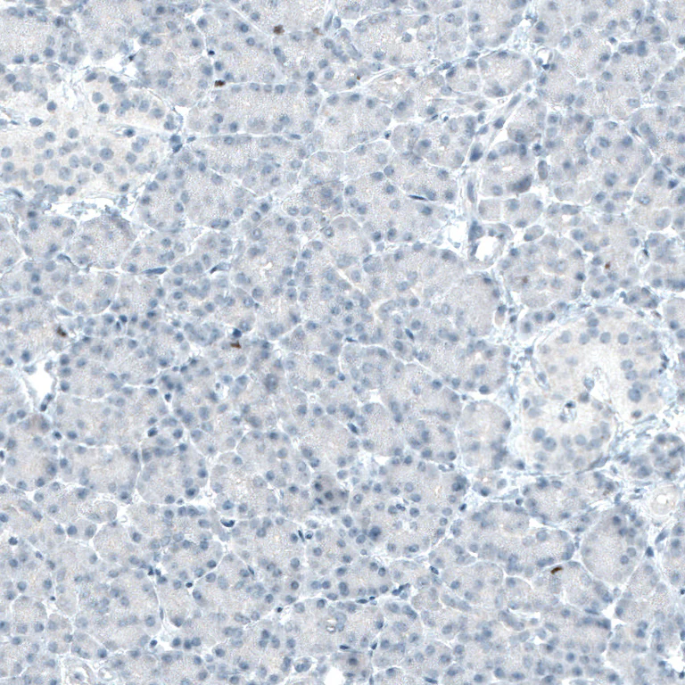 Immunohistochemistry (Formalin/PFA-fixed paraffin-embedded sections) - Anti-BCL11B Antibody [CL6426] (AB327121)