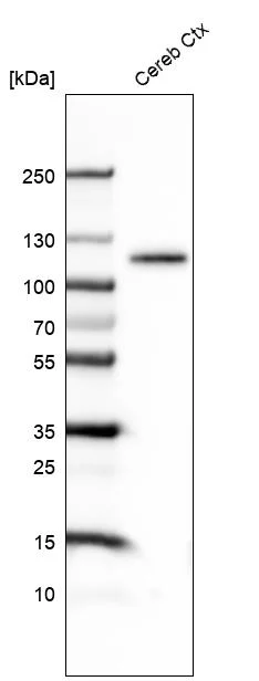 Western blot - Anti-BCL11B Antibody [CL6426] (AB327121)