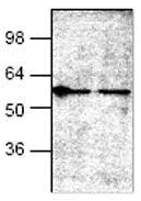 Western blot - Anti-Bcl2-L-13 antibody (AB27795)