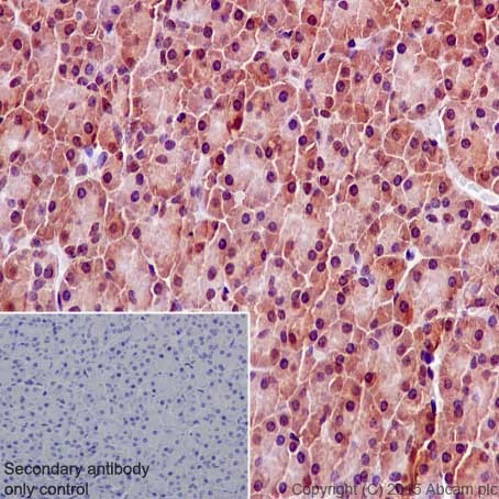 Immunohistochemistry (Formalin/PFA-fixed paraffin-embedded sections) - Anti-Bcl2-L-13 antibody [EP10625] (AB203516)